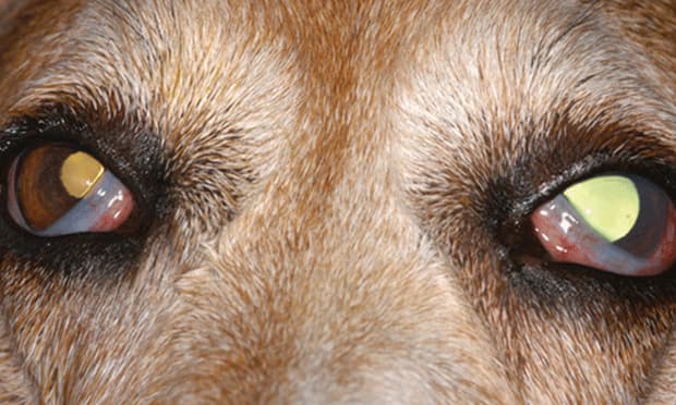 Glaucoma in gsd